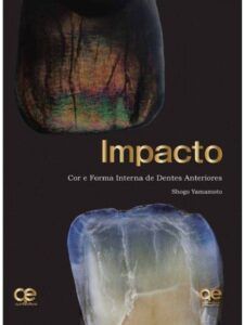 IMPACTO. COLOR Y FORMA INTERNA DE LOS DIENTES ANTERIORES